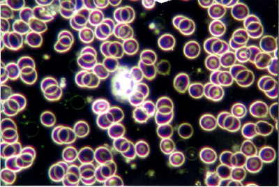 血球画像ターゲットセル